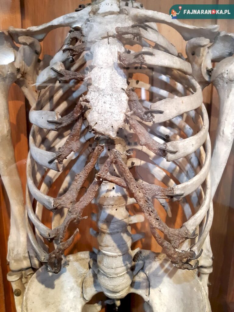 Ludzki szkielet, klatka piersiowa - Szpitala św. Ducha i Muzeum Medycyny we Fromborku.