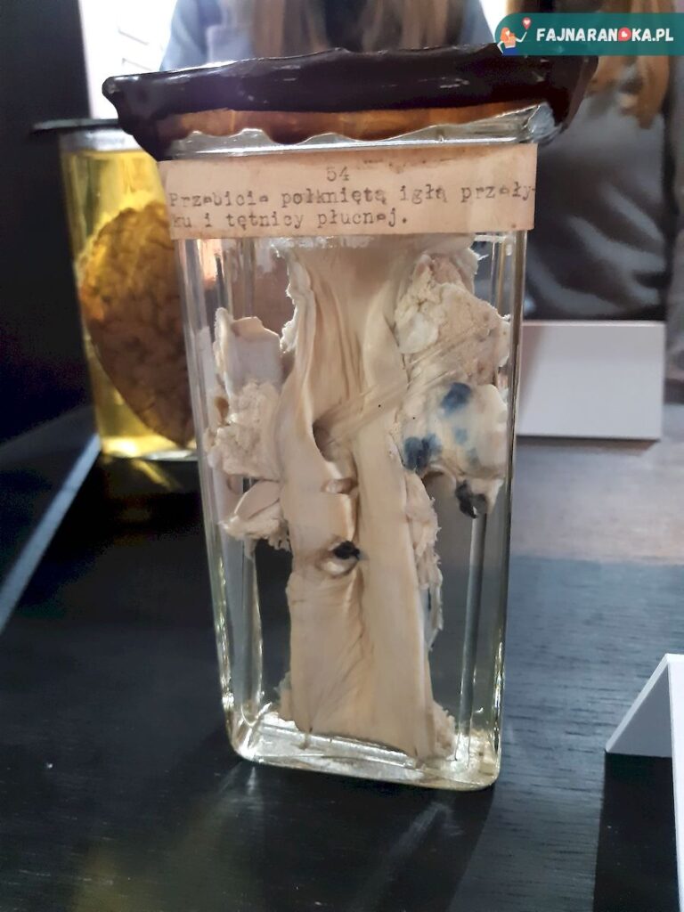 Preparat z połkniętą igłą w Muzeum Historii Medycyny we Fromborku.