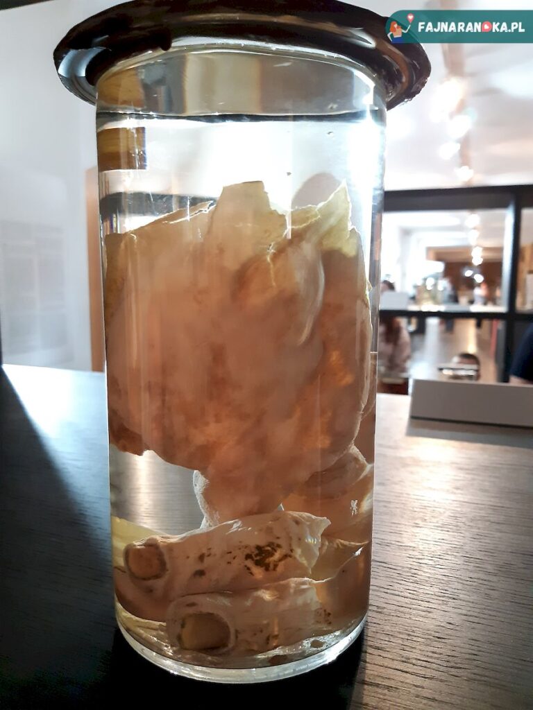 Preparat medyczny przedstawiający zjawisko nazywane skórą praczki prezentowany w Muzeum Medycyny we Fromborku.