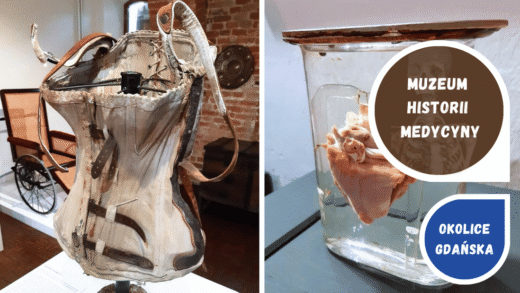 Randka z dreszczykiem w Muzeum Medycyny we Fromborku.