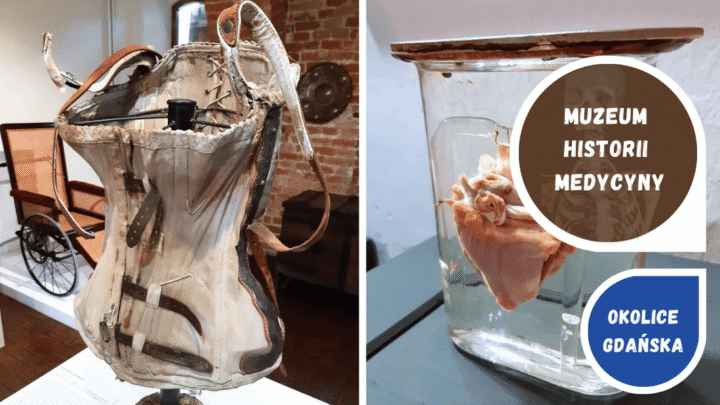 Randka z dreszczykiem w Muzeum Medycyny we Fromborku.
